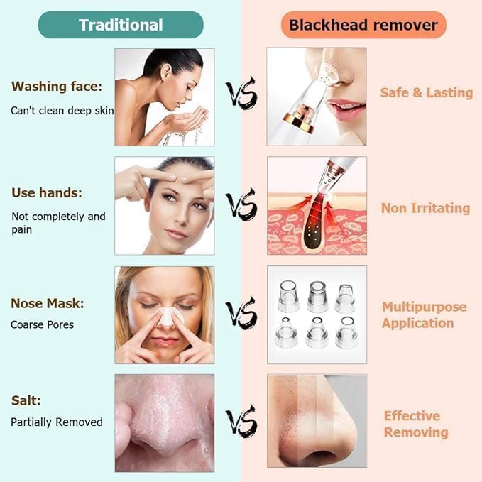 "ShineSkin™ Portable Blackhead Remover"