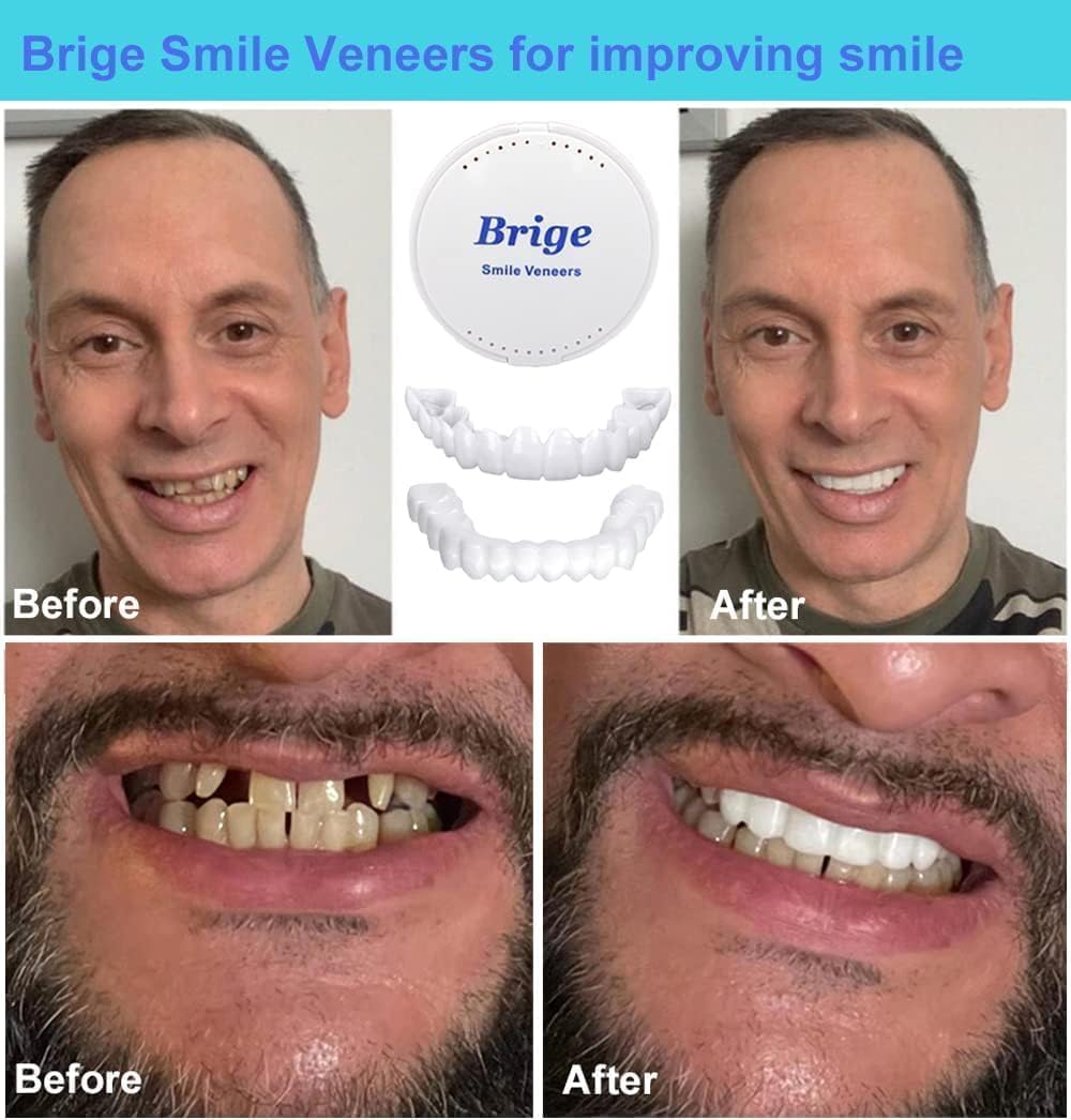 Instant and Confident on Smile Fit Flex Cosmetic Teeth Denture Teeth