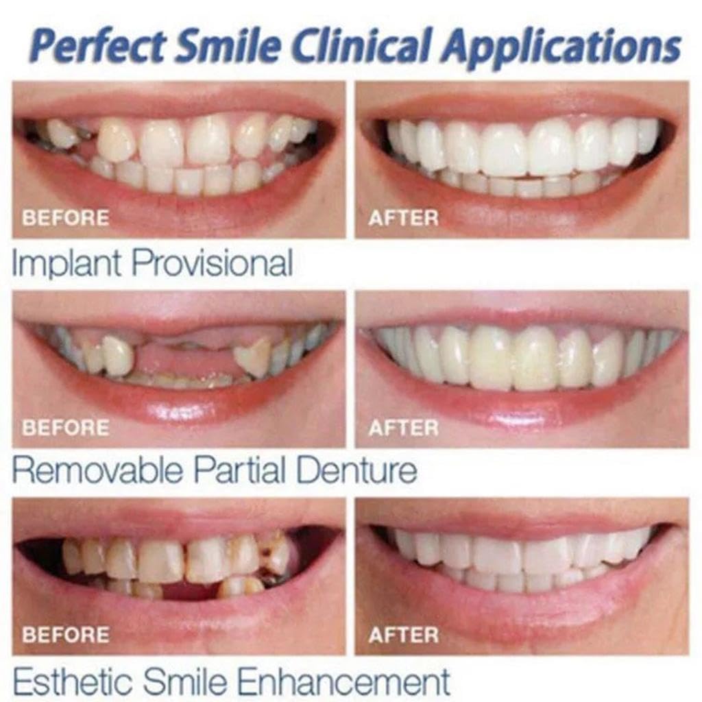 Instant and Confident on Smile Fit Flex Cosmetic Teeth Denture Teeth