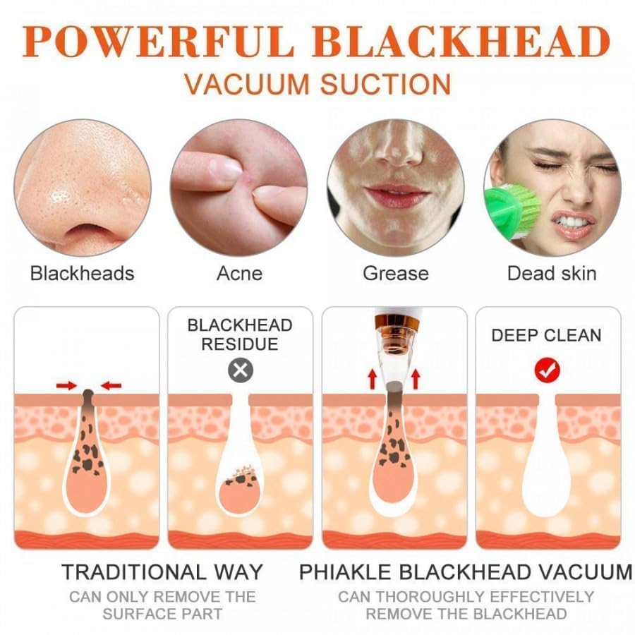 "ShineSkin™ Portable Blackhead Remover"